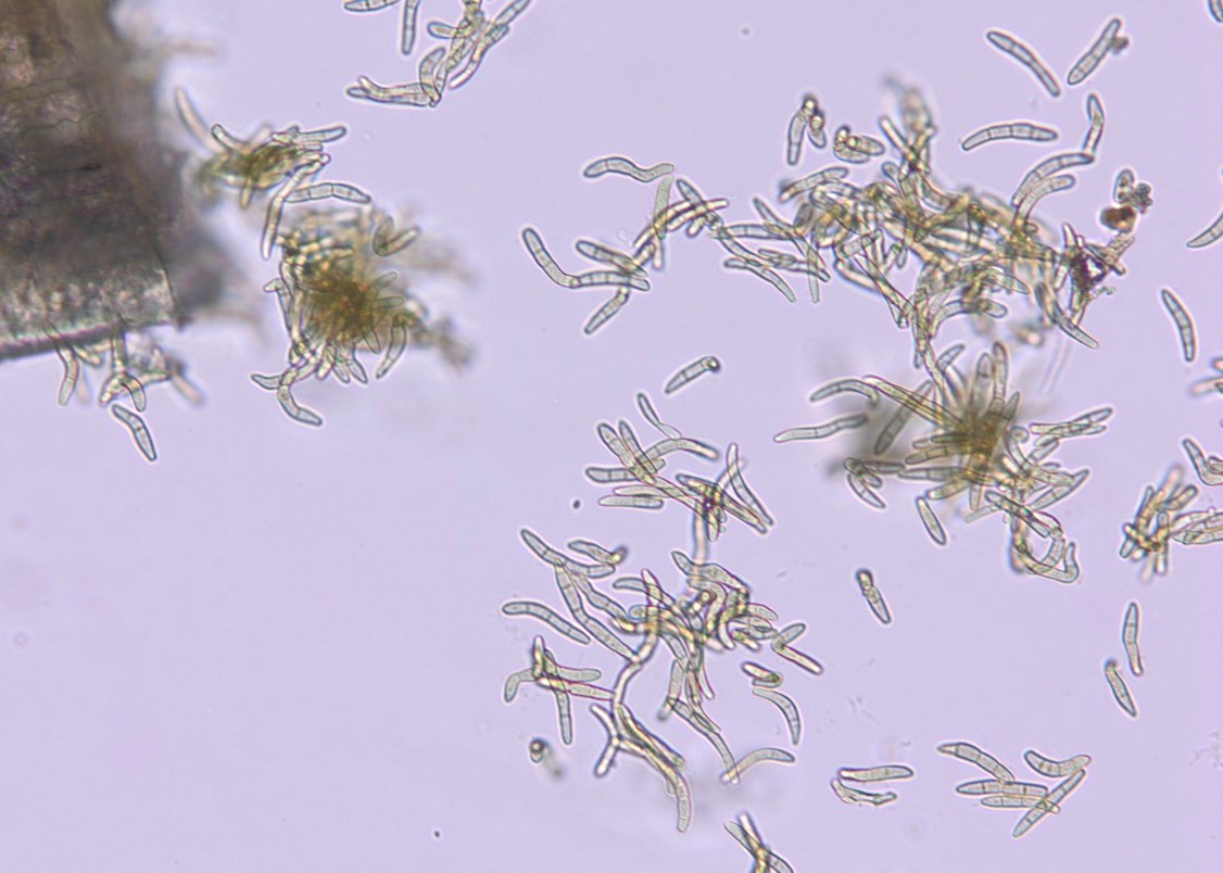 BSNB whitepine conidia.jpg